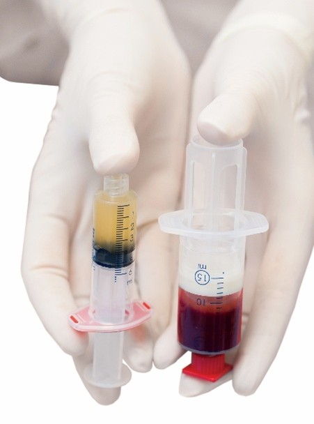 ACP-PRP
