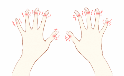 腱鞘炎
